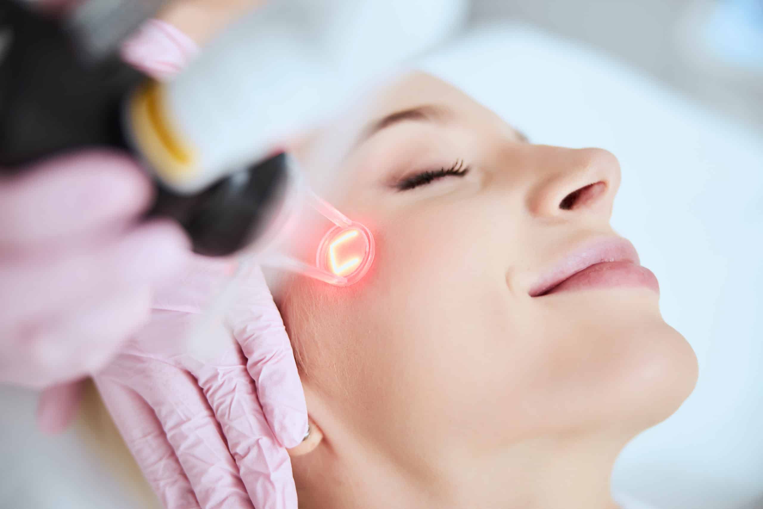 Your Guide to Laser Skin Resurfacing